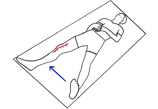 Person lying down with leg injury, medical diagram showing wound location