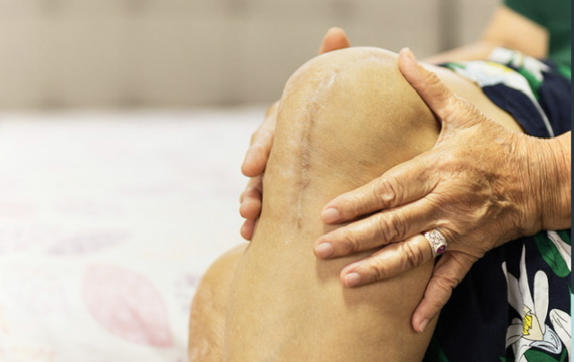 Aged hand gently touching a knee with a surgical scar
