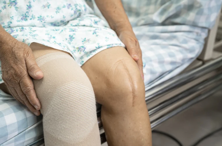 Patient wearing compression stocking sits on medical examination bed