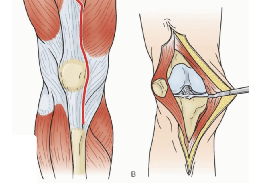 Anatomical diagram of knee joint showing muscles, tendons, and bones
