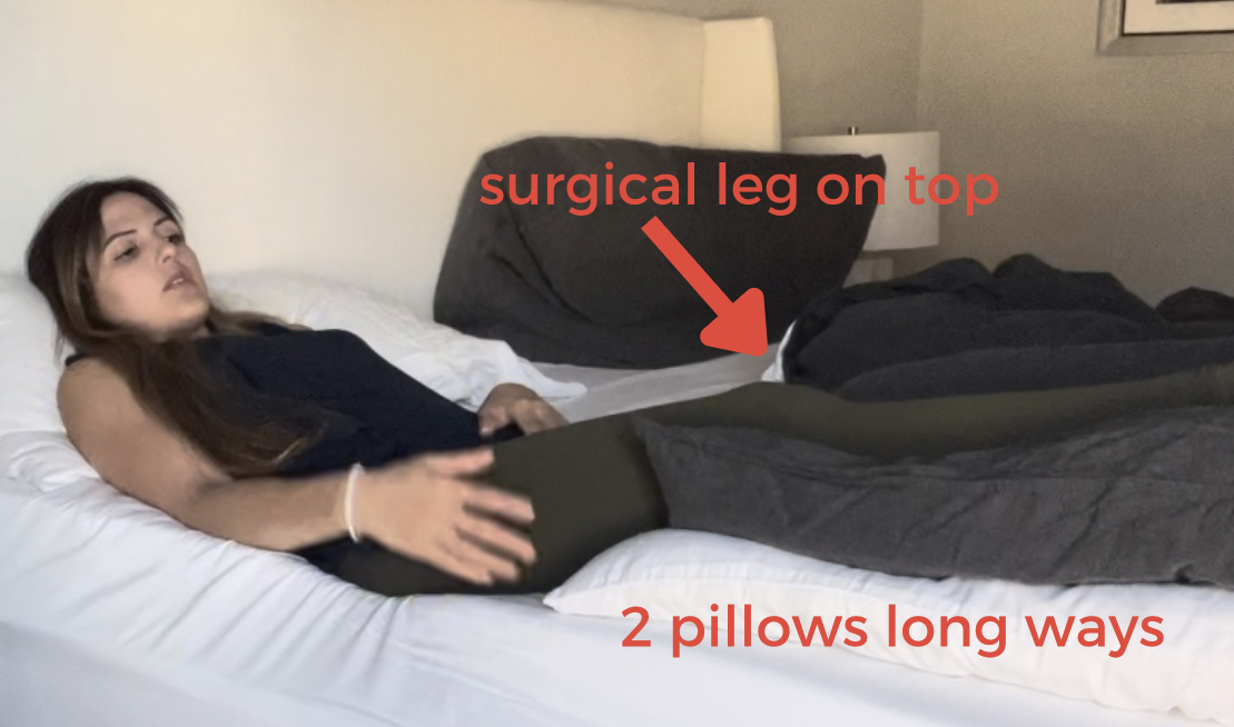 Person resting in bed with labeled surgical leg and pillow positioning