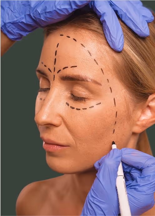 Lifting não cirúrgico