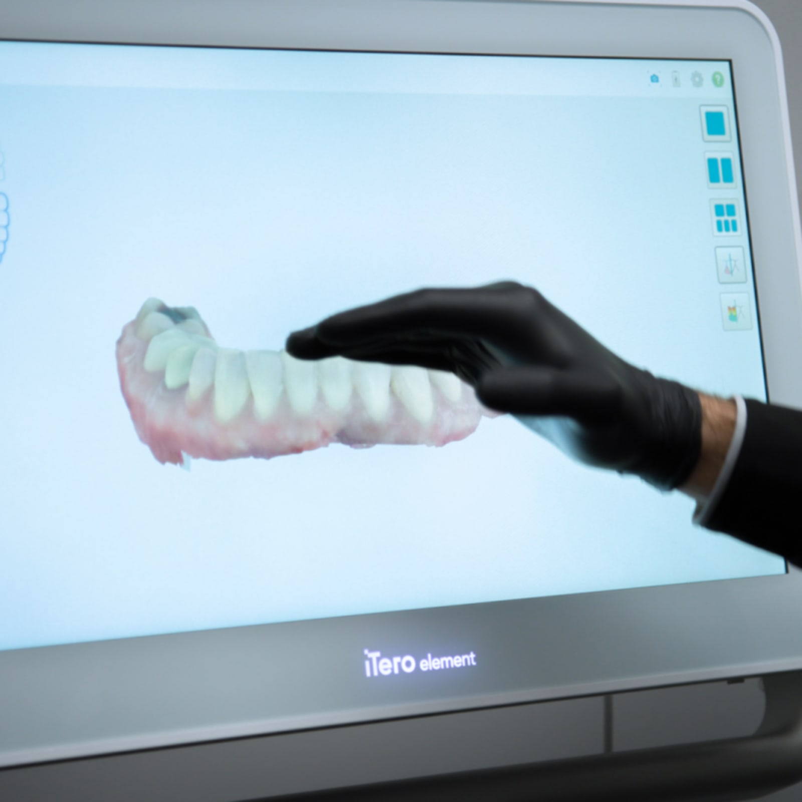 Digital display showing dental treatment plan on computer screen during consultation