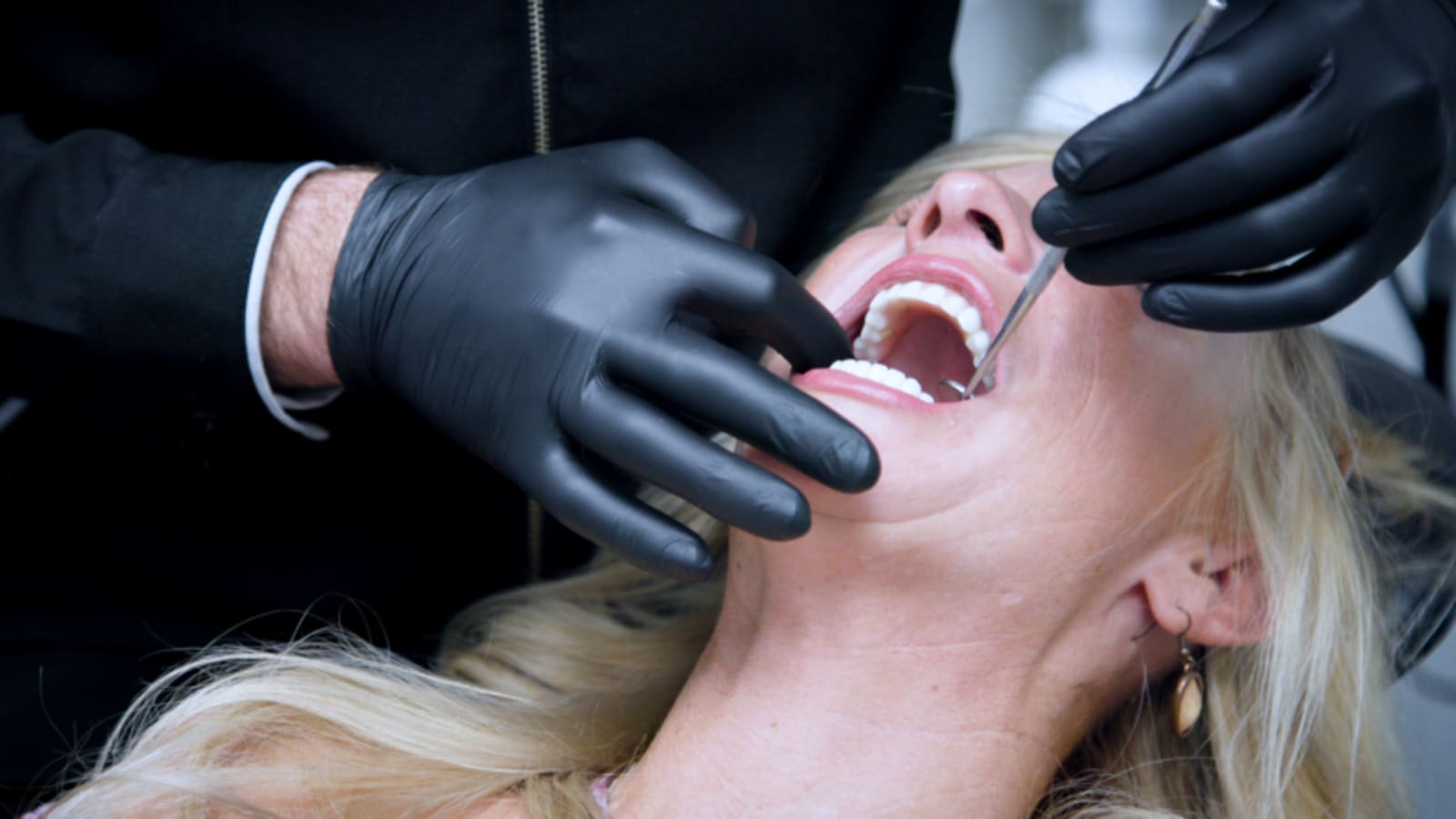 Dentist showing aligner trays to patient during treatment planning