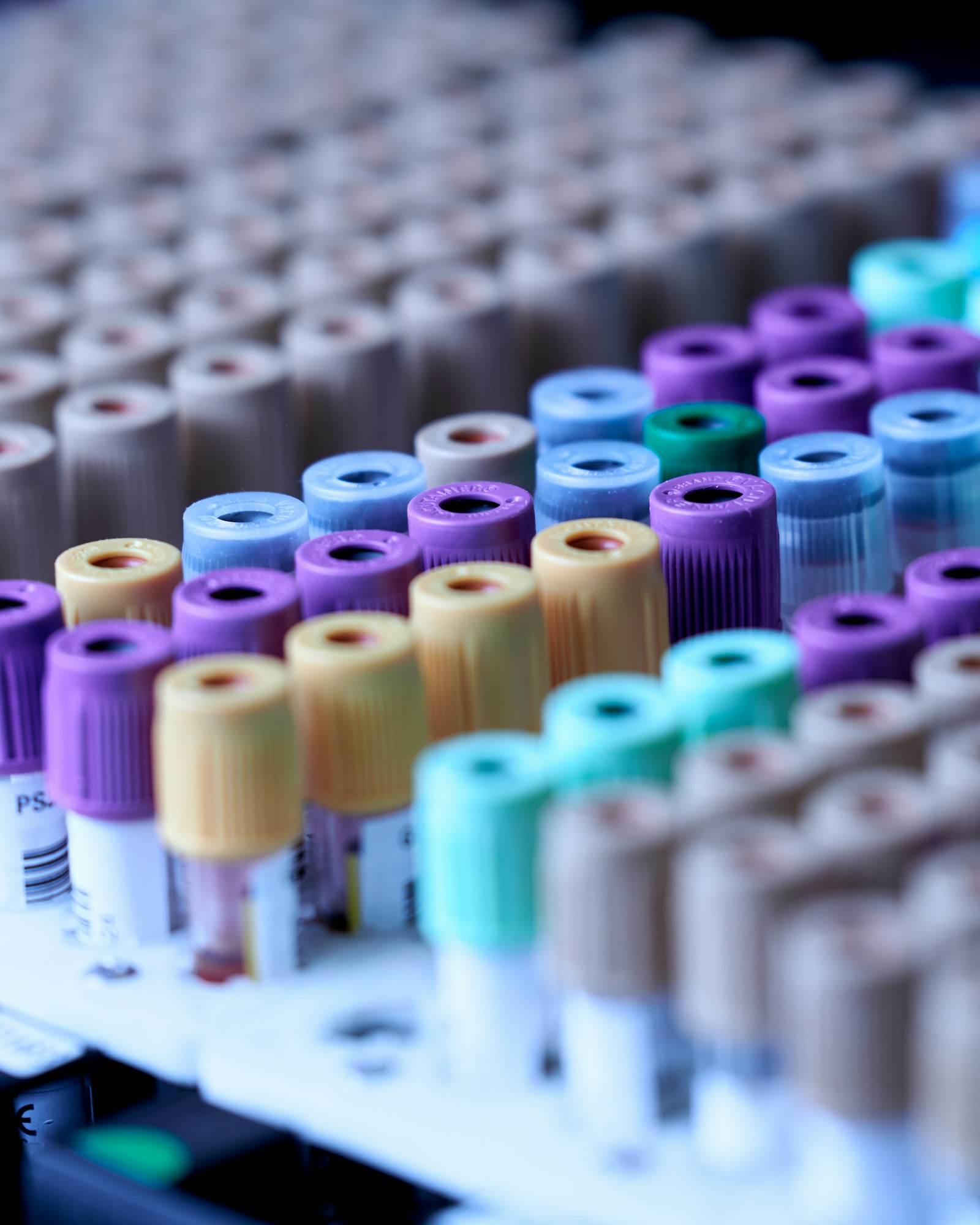 Racks of blood collection tubes prepared for laboratory analysis