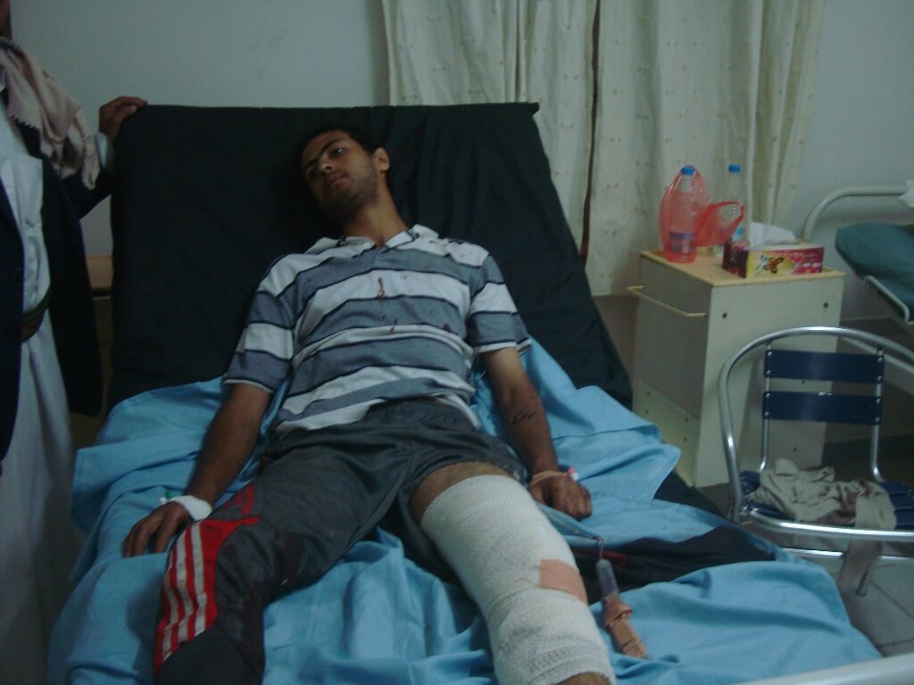 Mwatana Organization for Human Rights Demands a Serious Investigation, holding responsible the involved officials and Demanding the Authorities to stop Using Violence to Suppress Protests