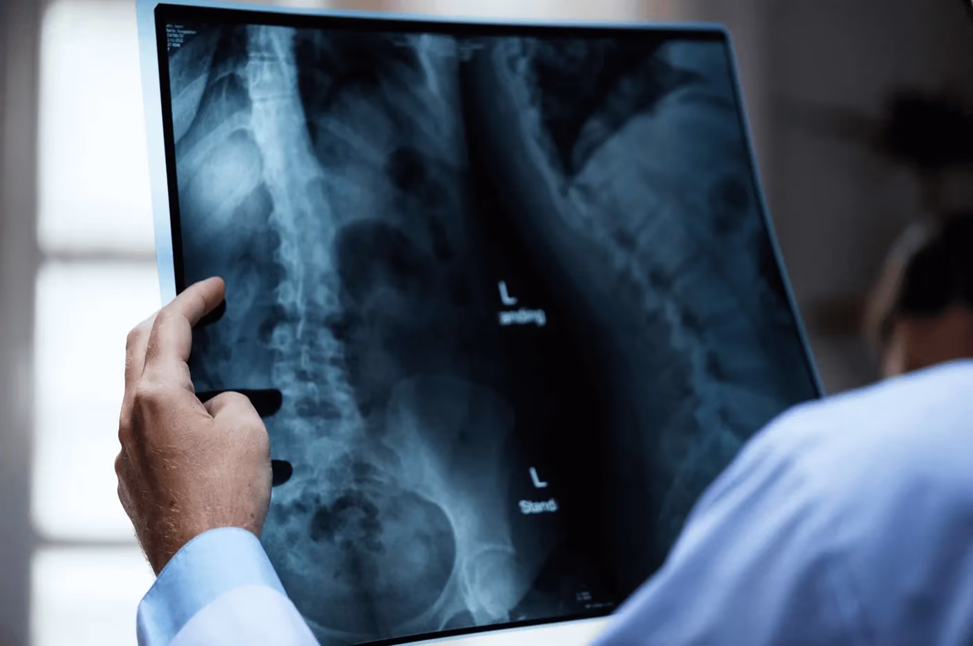 A neurosurgeon examines an X-ray of a patient’s spine prior to spinal fusion surgery in Los Angeles