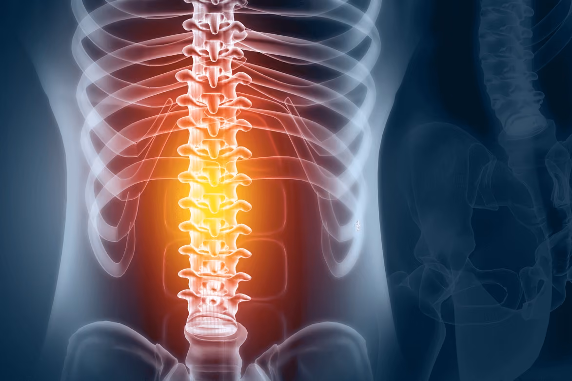 Illustration of an inflamed human spine and lower back highlighted in red, representing spinal pain or injury treated by the best spine surgeon in Los Angeles.
