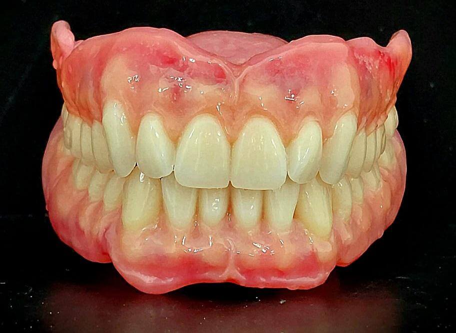 Bioart Dentures