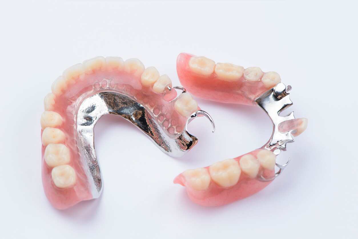 Titanium Dentures