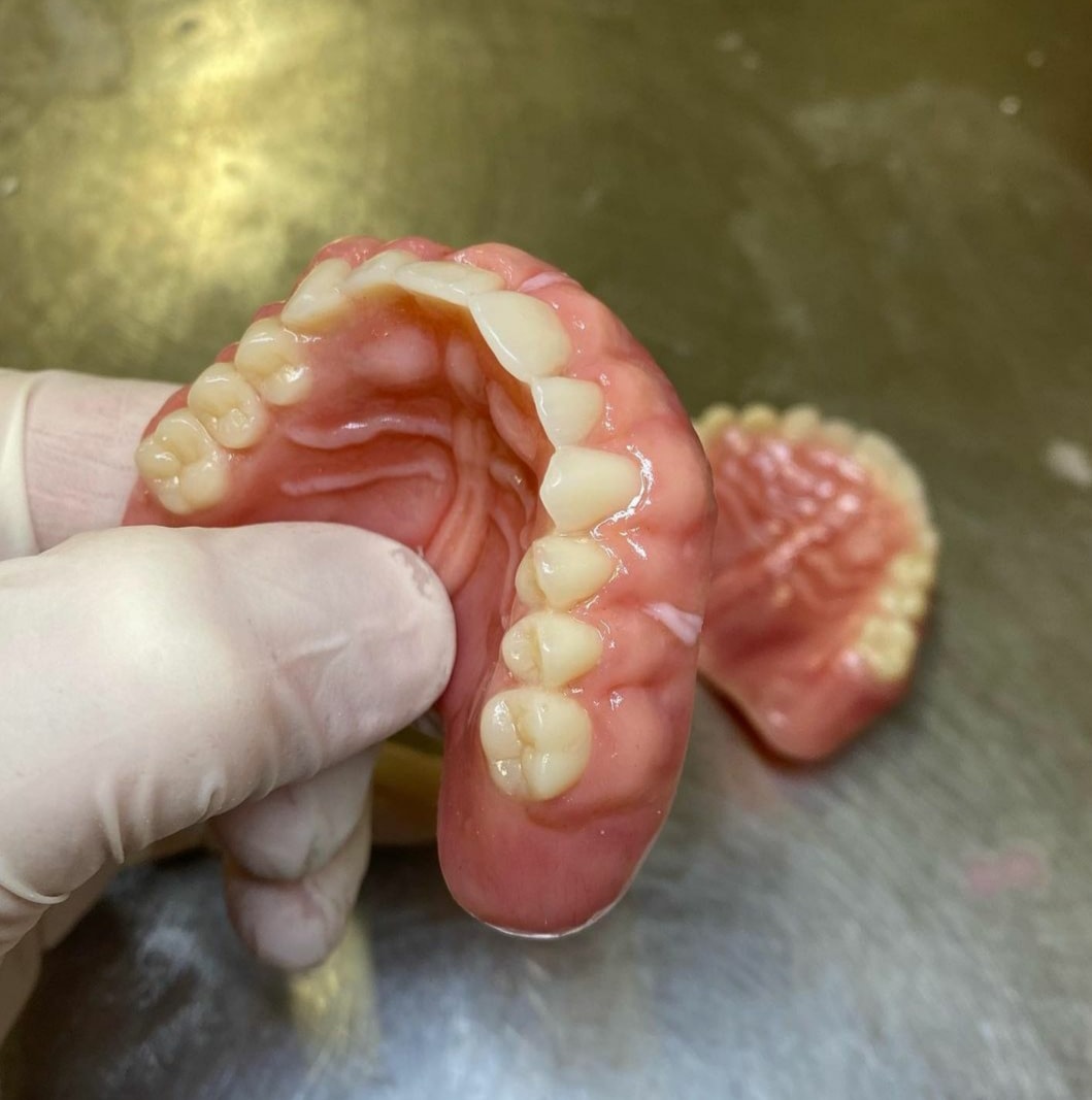 Titanium Dentures