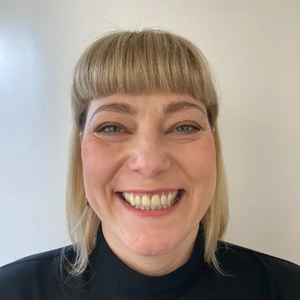 Nahaufnahme einer lächelnden Frau mit gelblichen und verhältnismäßig großen Zähnen, vor einer Veneers Behandlung