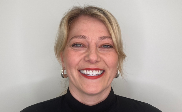 Frau mittleren Alters mit die freundlich lächelt und weiße Zähne zeigt. Die Zähne wurden mit ästhetischen Zahnmedizin Behandlungen behandelt.