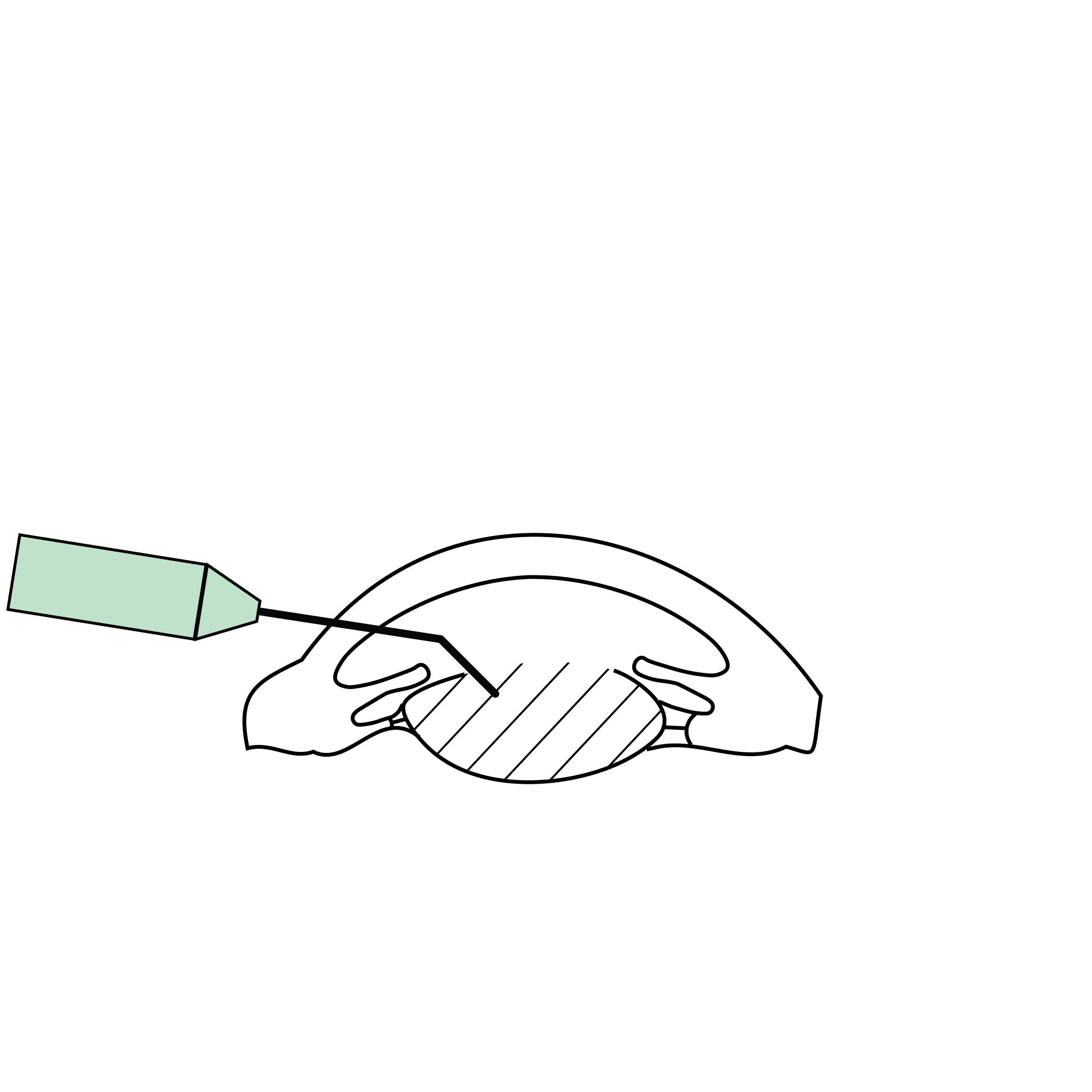 Cornée, Cataracte et Lentilles intraoculaires