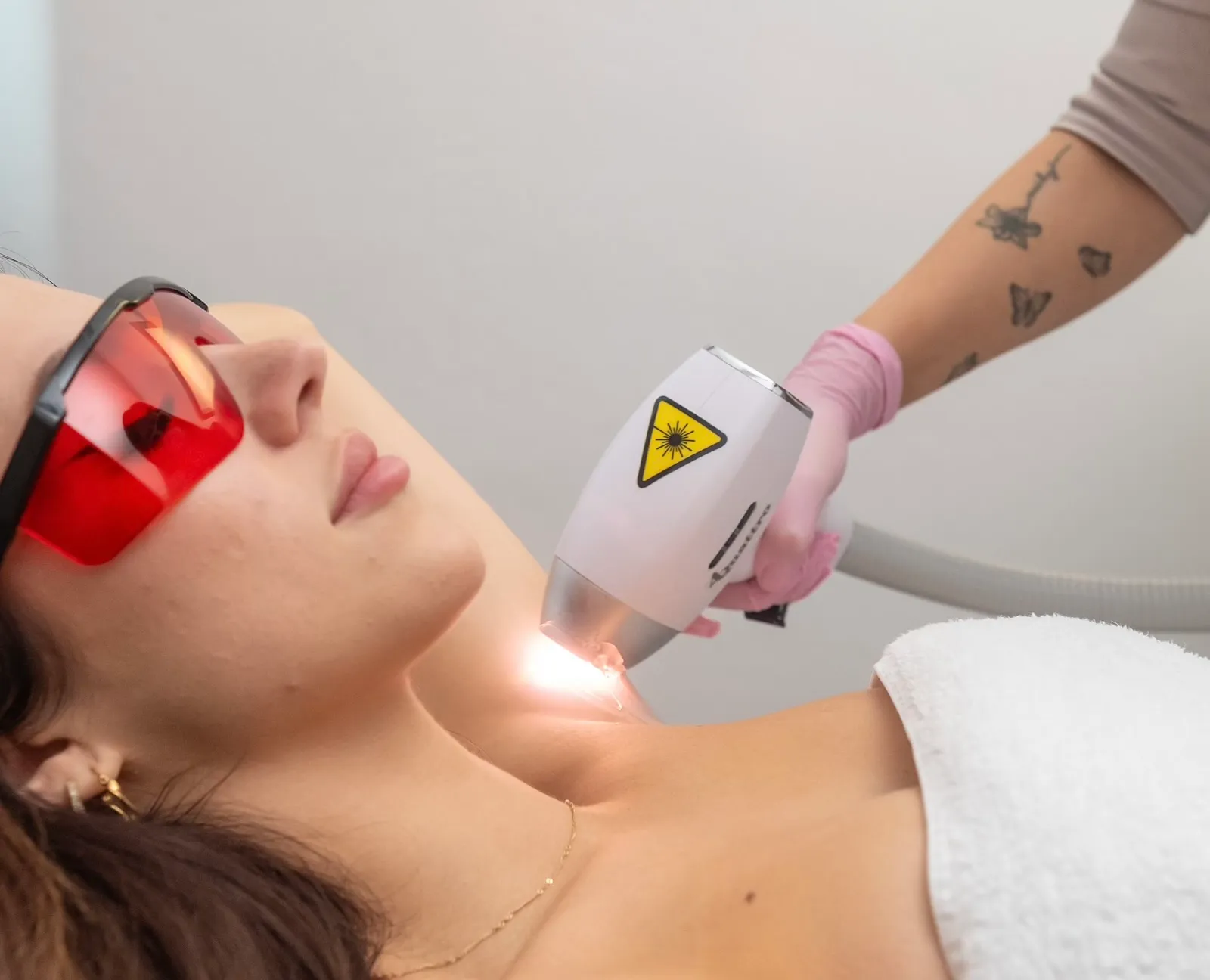 Laserová epilácia - Epilux System™