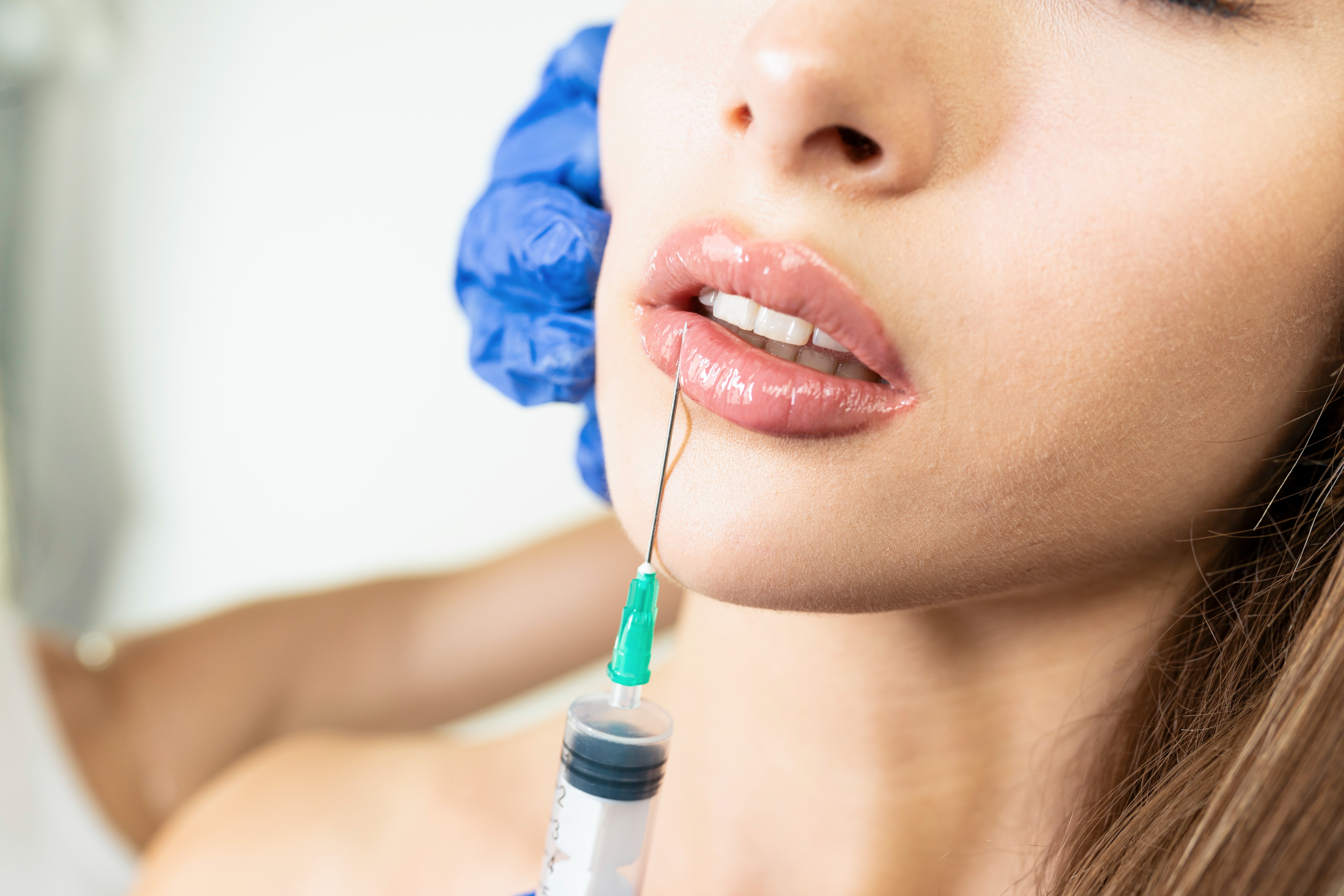 Rozpustenie kyseliny hyalurónovej: Čo potrebujete vedieť