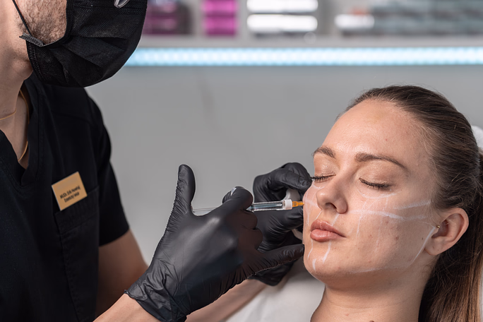 RADIESSE® – Kolagén-stimulačný dermálny výplňový biostimulátor pre pevnejšiu a mladšiu pokožku