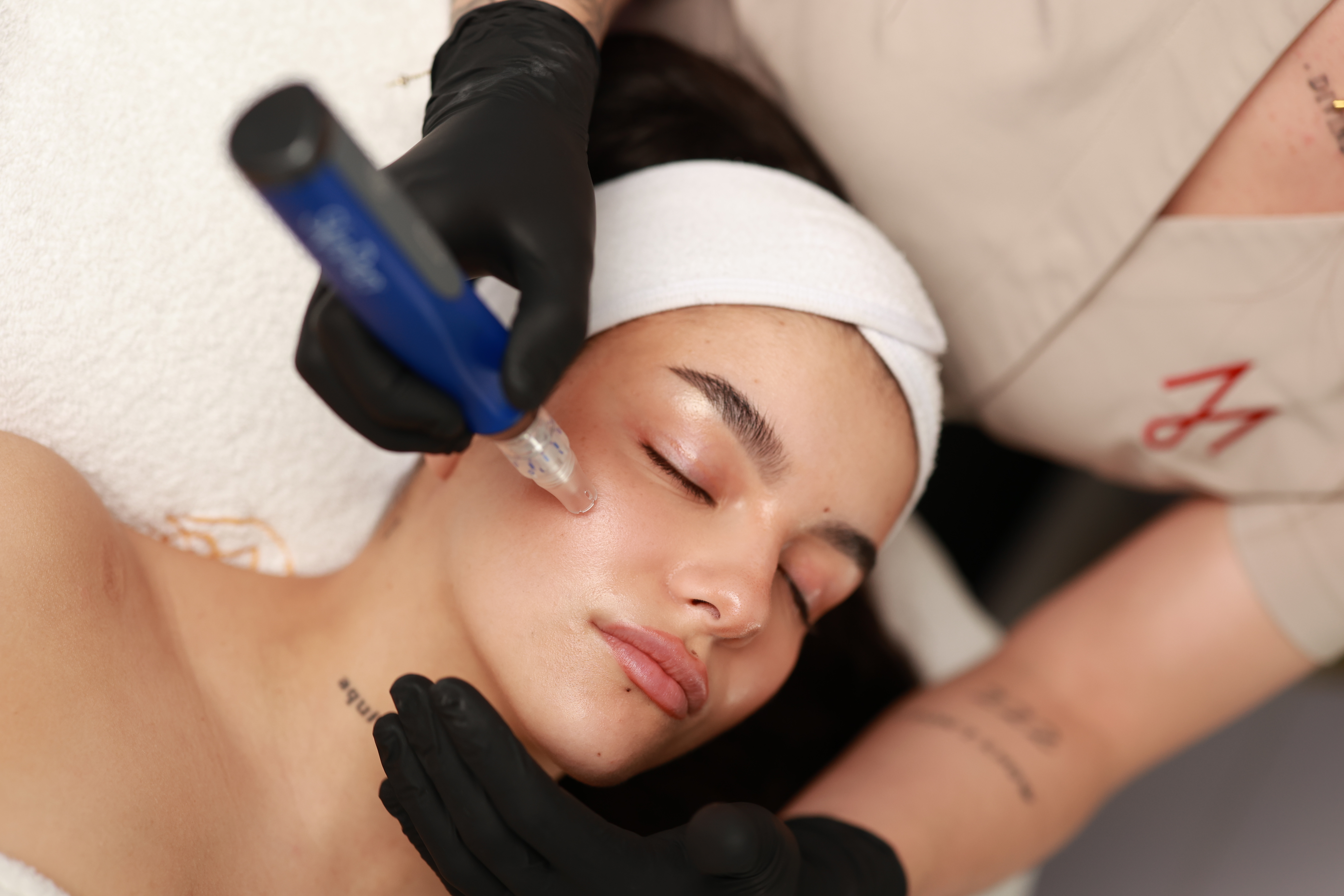 SkinPen® – Medicínsky microneedling pre regeneráciu a omladenie pokožky