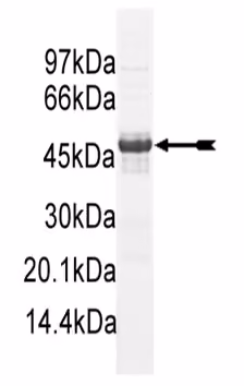 SGK1 (S422D), unactive Human Recombinant Kinase Protein