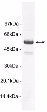 PRAK, unactive Human Recombinant Kinase Protein