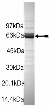 ROKα/ROCK-II, active, rat Rat Recombinant Kinase Protein