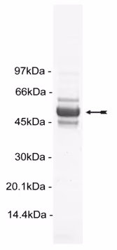 Akt2/PKBβ (δPH, S474D), active Human Recombinant Kinase Protein