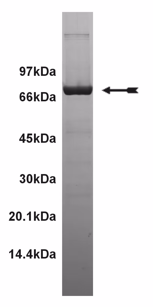 CSK, active Human Recombinant Kinase Protein