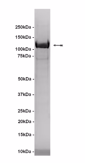 IKKα, active Human Recombinant Kinase Protein