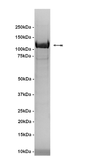 IKKα, active Human Recombinant Kinase Protein