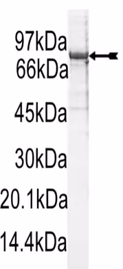 PKCβI, active Human Recombinant Kinase Protein