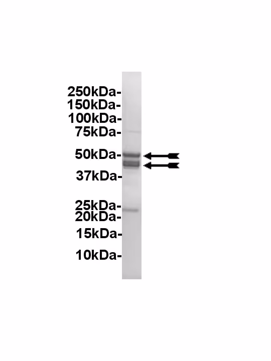 Casein Kinase 2, active Human Recombinant Kinase Protein