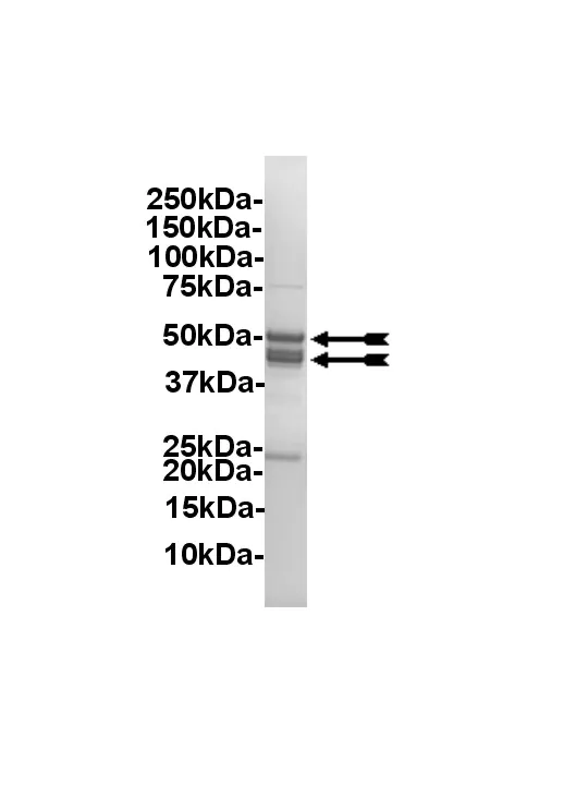 Casein Kinase 2, active Human Recombinant Kinase Protein