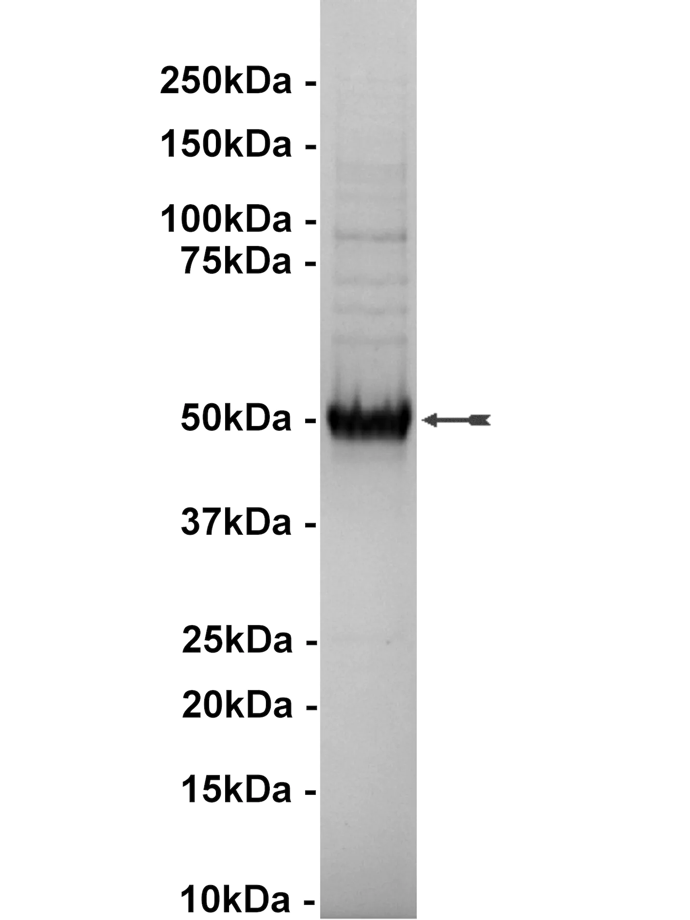 GSK3β, active Human Recombinant Kinase Protein