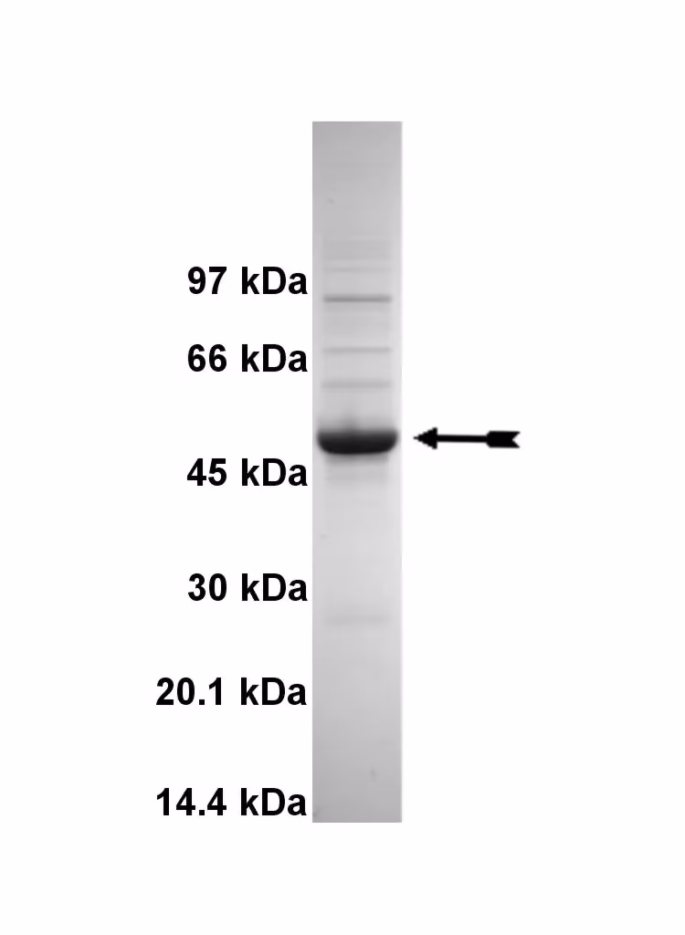 SGK1 (δ1-59, S422D), active Human Recombinant Kinase Protein