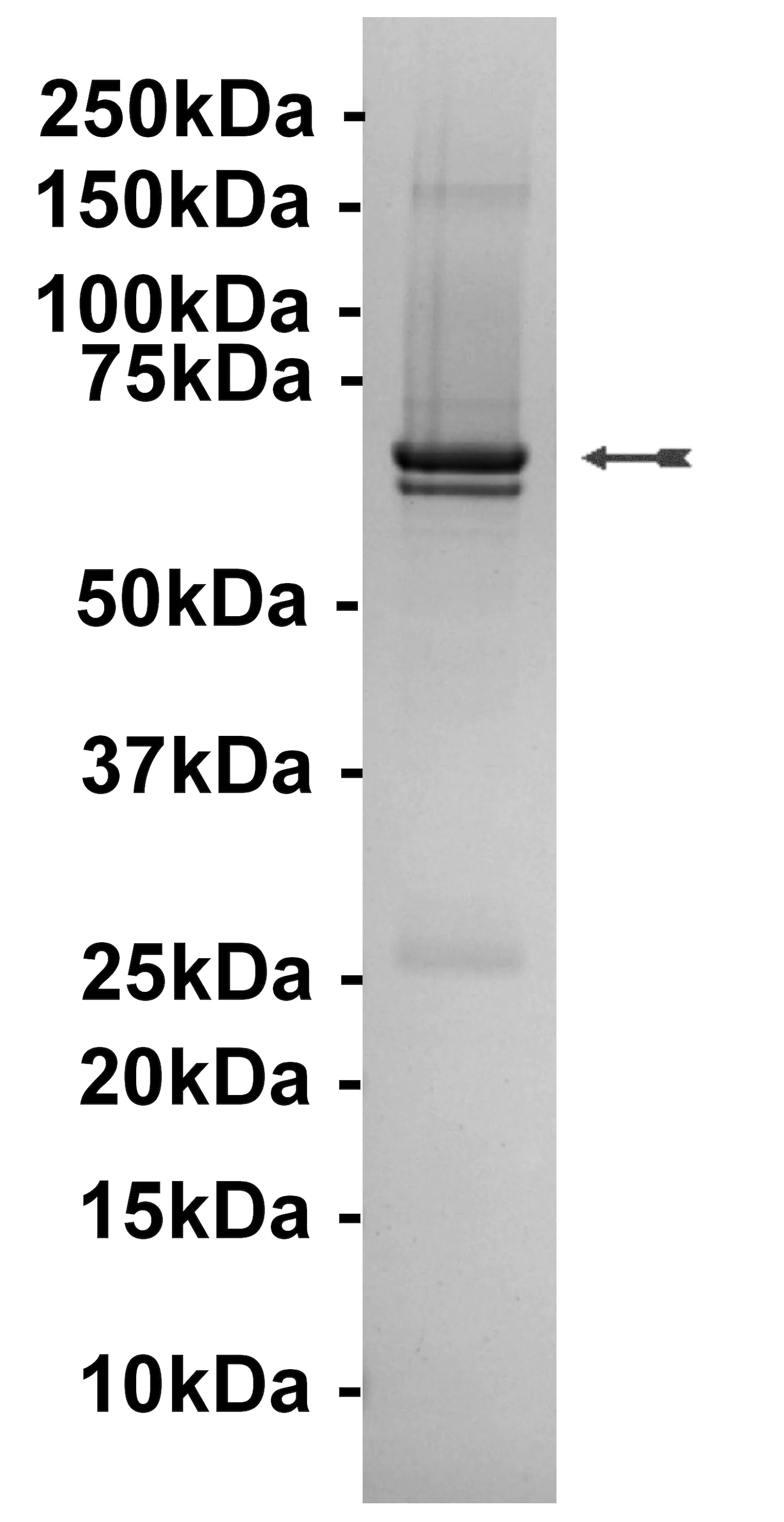 MAPKAP Kinase 2, unactive Human Recombinant Kinase Protein