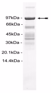 CHK2, active Human Recombinant Kinase Protein