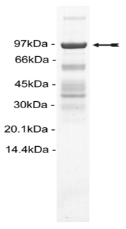 CHK2, active Human Recombinant Kinase Protein