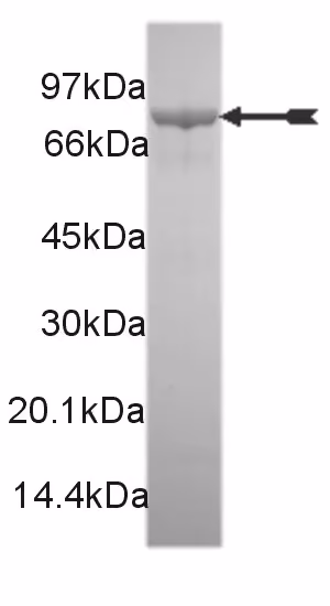 MKK6/SKK3 (S599D, T603D), active Human Recombinant Kinase Protein