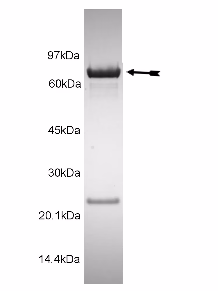 CHK1, active Human Recombinant Kinase Protein