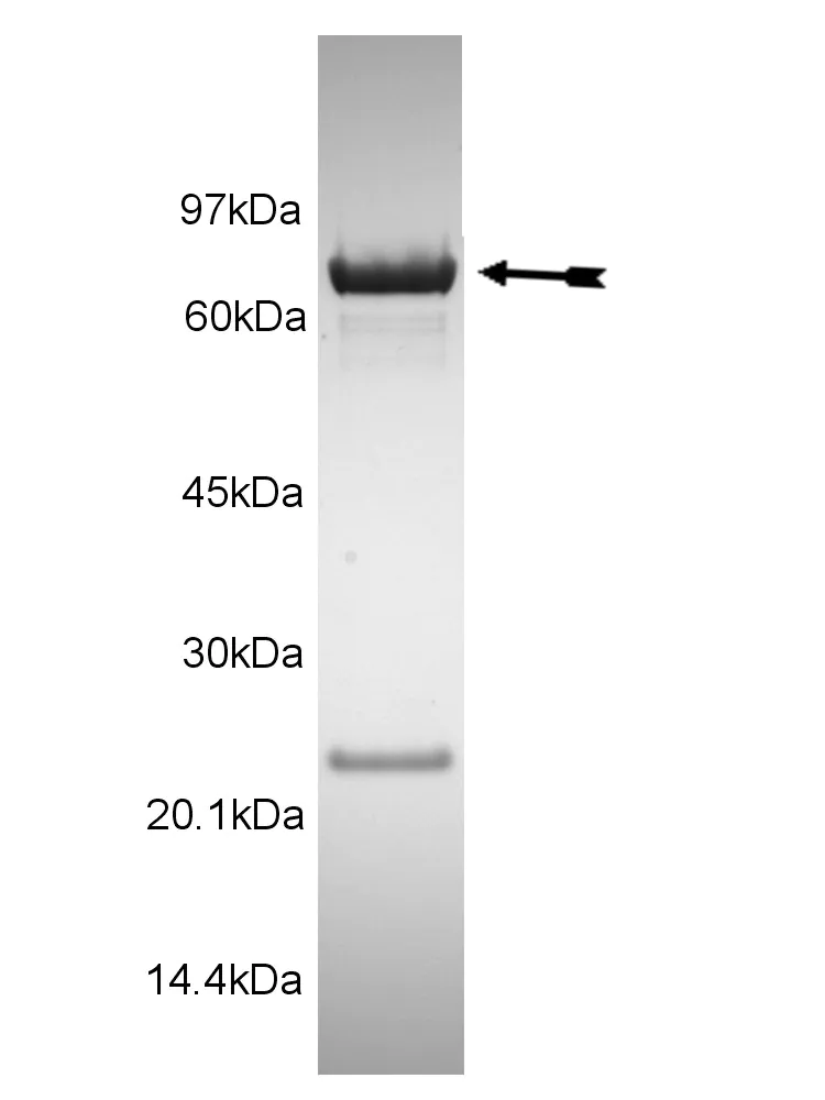 CHK1, active Human Recombinant Kinase Protein