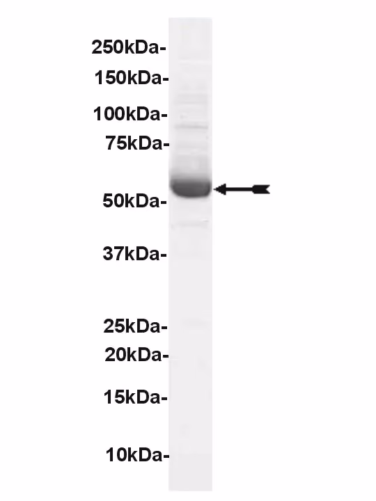 Lck, active Human Recombinant Kinase Protein