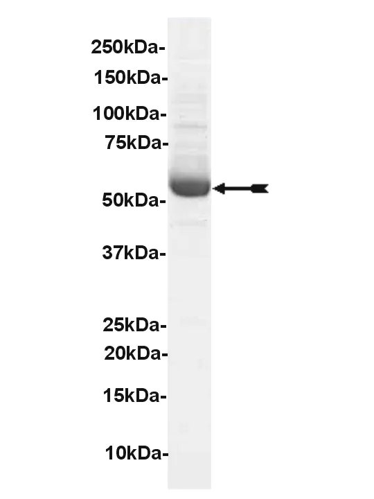 Lck, active Human Recombinant Kinase Protein