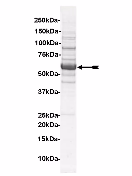 Fyn, active Human Recombinant Kinase Protein