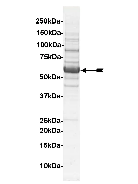 Fyn, active Human Recombinant Kinase Protein