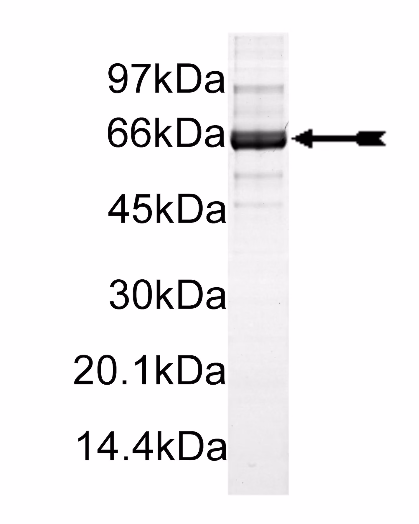 ROKα/ROCK-II, active Human Recombinant Kinase Protein