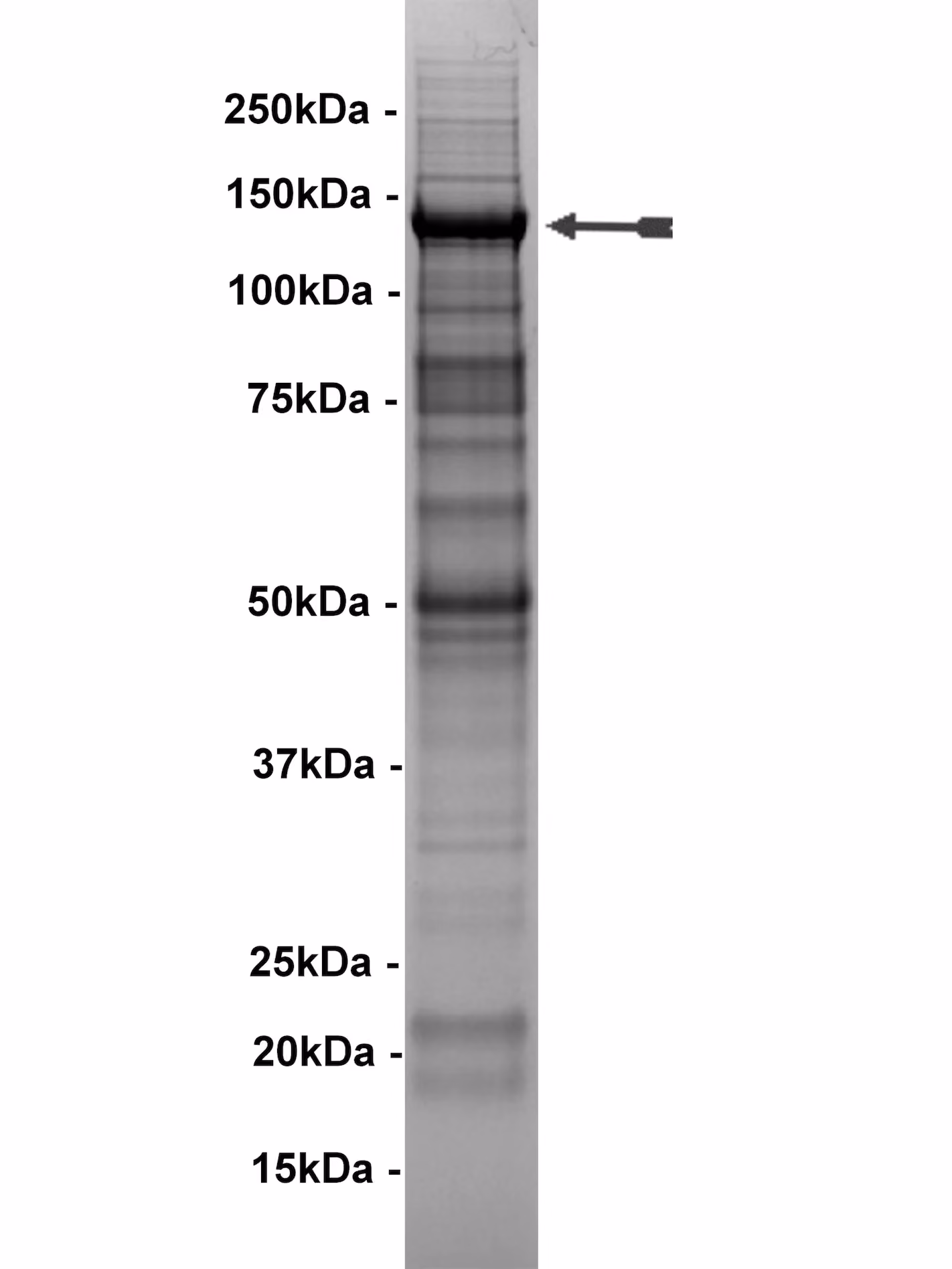 Abl, active, mouse Mouse Recombinant Kinase Protein