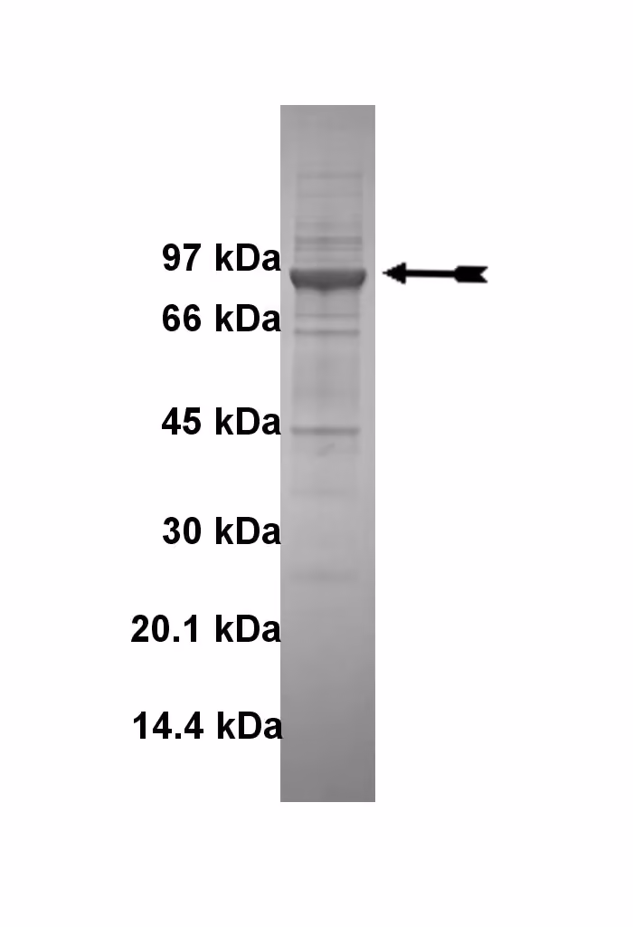 Fes/Fps, active Human Recombinant Kinase Protein