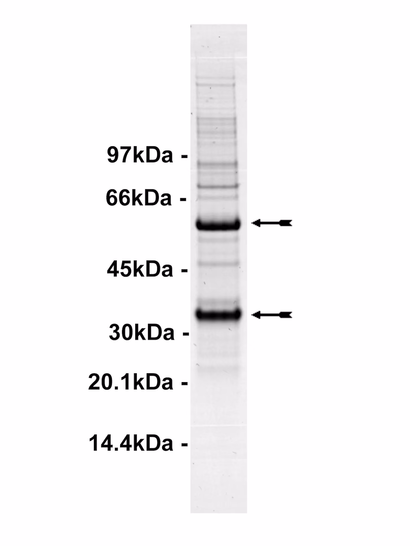 Cdk5/p35, active Human Recombinant Kinase Protein