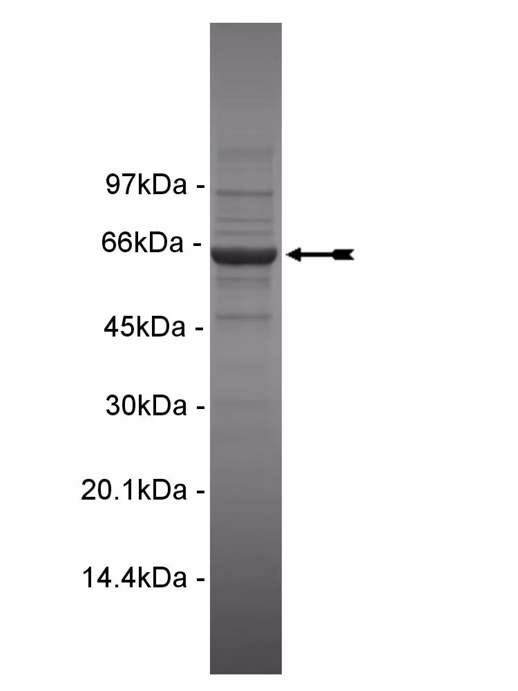 Yes, active Human Recombinant Kinase Protein