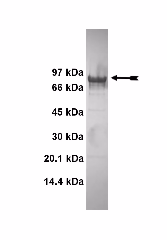 PKCβII, active Human Recombinant Kinase Protein